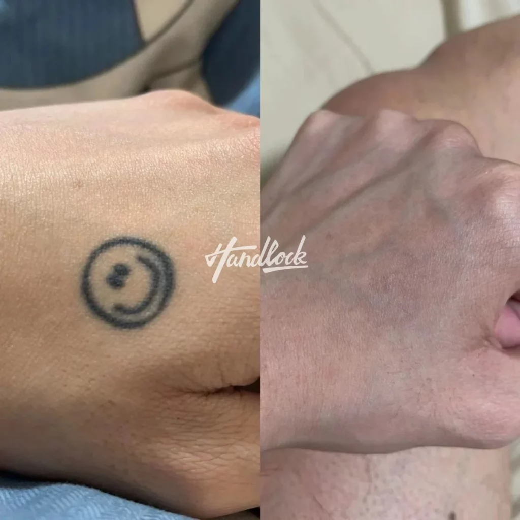 清洗5次，拼接图