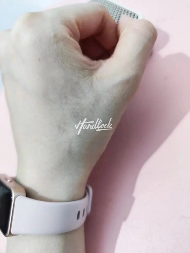 清洗4次，术后图